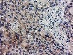 RASD2 Antibody in Immunohistochemistry (Paraffin) (IHC (P))