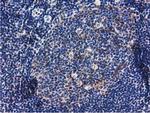 RASD2 Antibody in Immunohistochemistry (Paraffin) (IHC (P))