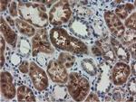 RASD2 Antibody in Immunohistochemistry (Paraffin) (IHC (P))