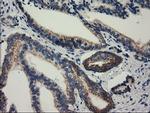 RASD2 Antibody in Immunohistochemistry (Paraffin) (IHC (P))