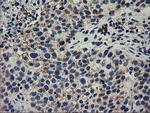 RASD2 Antibody in Immunohistochemistry (Paraffin) (IHC (P))