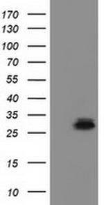 RASD2 Antibody in Western Blot (WB)