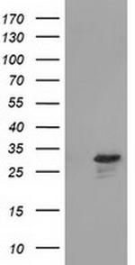 RASD2 Antibody in Western Blot (WB)