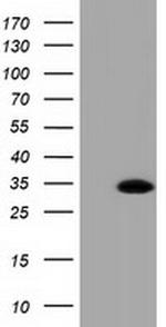 RASD2 Antibody in Western Blot (WB)