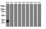 RASD2 Antibody in Western Blot (WB)