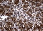 RASGRP3 Antibody in Immunohistochemistry (Paraffin) (IHC (P))