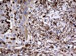 RASGRP3 Antibody in Immunohistochemistry (Paraffin) (IHC (P))