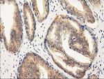 RASSF1 Antibody in Immunohistochemistry (Paraffin) (IHC (P))