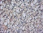 RASSF1 Antibody in Immunohistochemistry (Paraffin) (IHC (P))