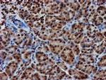 RASSF1 Antibody in Immunohistochemistry (Paraffin) (IHC (P))