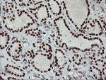 RASSF1 Antibody in Immunohistochemistry (Paraffin) (IHC (P))