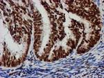 RASSF1 Antibody in Immunohistochemistry (Paraffin) (IHC (P))