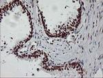 RASSF1 Antibody in Immunohistochemistry (Paraffin) (IHC (P))