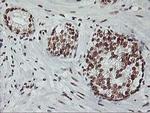 RASSF1 Antibody in Immunohistochemistry (Paraffin) (IHC (P))