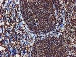 RASSF1 Antibody in Immunohistochemistry (Paraffin) (IHC (P))