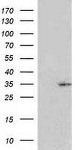 RASSF5 Antibody in Western Blot (WB)