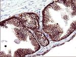 RASSF8 Antibody in Immunohistochemistry (Paraffin) (IHC (P))