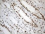 RB1 Antibody in Immunohistochemistry (Paraffin) (IHC (P))