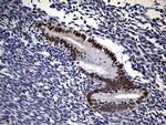 RB1 Antibody in Immunohistochemistry (Paraffin) (IHC (P))