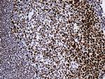 RB1 Antibody in Immunohistochemistry (Paraffin) (IHC (P))