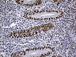 RB1 Antibody in Immunohistochemistry (Paraffin) (IHC (P))