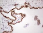 RB1 Antibody in Immunohistochemistry (Paraffin) (IHC (P))