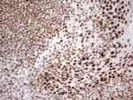 RB1 Antibody in Immunohistochemistry (Paraffin) (IHC (P))