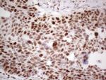 RB1 Antibody in Immunohistochemistry (Paraffin) (IHC (P))