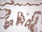 RB1 Antibody in Immunohistochemistry (Paraffin) (IHC (P))