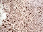 RB1 Antibody in Immunohistochemistry (Paraffin) (IHC (P))