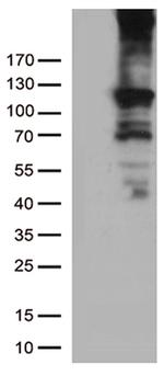 RB1 Antibody in Western Blot (WB)