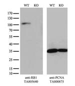 RB1 Antibody in Western Blot (WB)