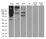 RB1 Antibody in Western Blot (WB)