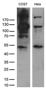 RB1 Antibody in Western Blot (WB)