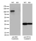 RB1 Antibody in Western Blot (WB)