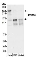 RBBP6 Antibody in Western Blot (WB)