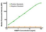 RBBP9 Antibody in Luminex (LUM)