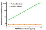 RBBP9 Antibody in Luminex (LUM)