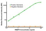 RBBP9 Antibody in Luminex (LUM)