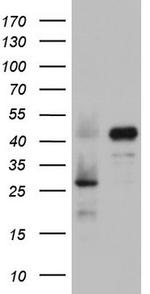 RBFOX1 Antibody in Western Blot (WB)