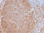 HLA-Pan (MHC II) Antibody in Immunohistochemistry (Paraffin) (IHC (P))