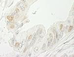 RBM10 Antibody in Immunohistochemistry (IHC)