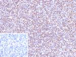 Epstein-Barr Virus (LMP-1) Antibody in Immunohistochemistry (Paraffin) (IHC (P))