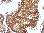 Cytokeratin, Acidic (Type I or LMW) Antibody in Immunohistochemistry (Paraffin) (IHC (P))