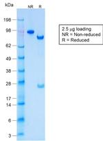 Cytokeratin, Acidic (Type I or LMW) Antibody in SDS-PAGE (SDS-PAGE)