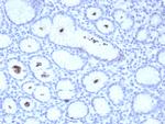 Helicobacter pylori (Catalase) Antibody in Immunohistochemistry (Paraffin) (IHC (P))