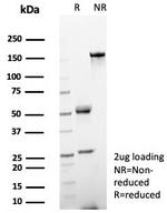 Helicobacter pylori (Catalase) Antibody in SDS-PAGE (SDS-PAGE)