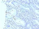 Helicobacter pylori (Catalase) Antibody in Immunohistochemistry (Paraffin) (IHC (P))