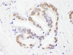 RBM26 Antibody in Immunohistochemistry (IHC)