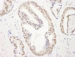 RBM26 Antibody in Immunohistochemistry (IHC)